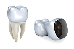 Crowns and Caps | Middlebury Dental Group | Dentist Naugatuck, CT